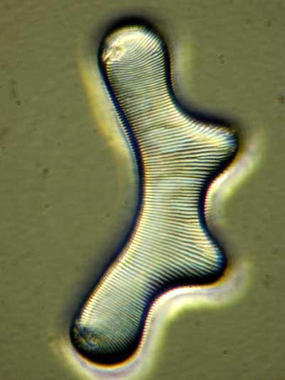 Picture of a diatom
